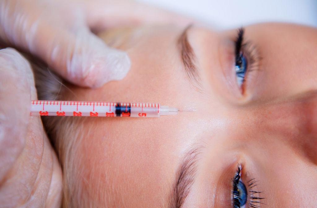 woman getting botox injected between her eyebrows