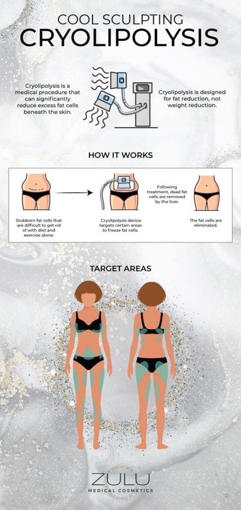 Infographic explaining how cryolipolysis or coolsculpting works