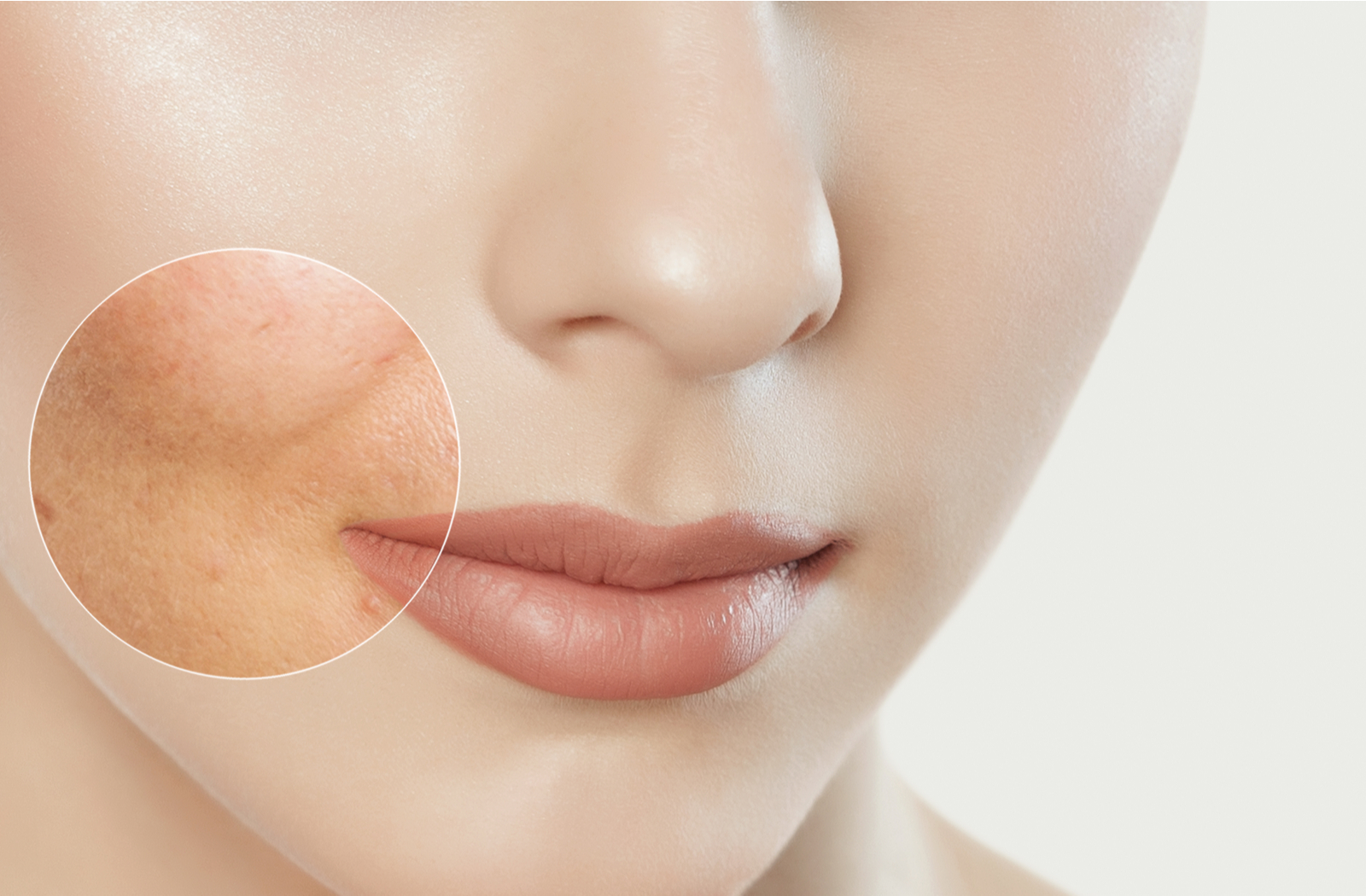 Close up and focused image of before and after of laser skin resurfacing of skin