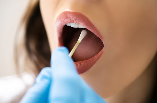 Closeup image of a woman having her mouth swabbed for DNA.