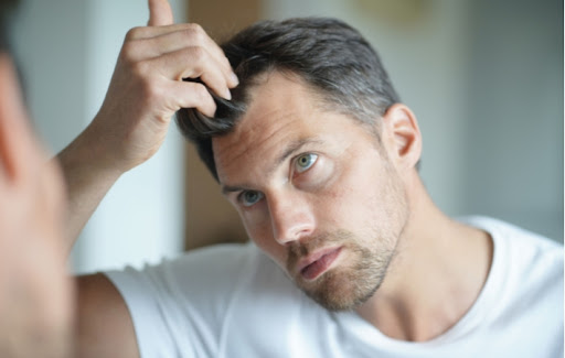 A man in his 40s inspects his receding hairline.