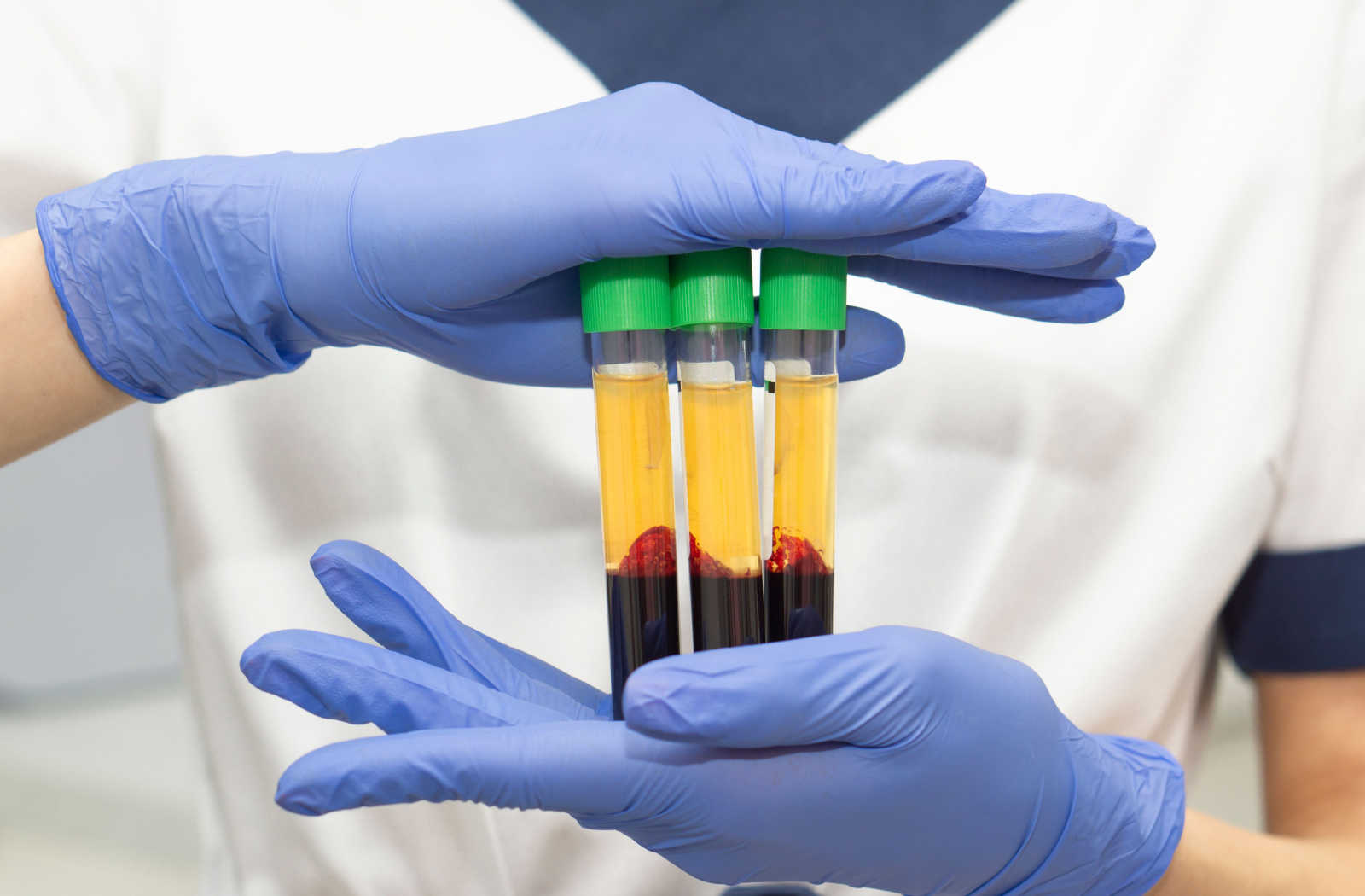 A nurse holds three vials of centrifuged blood.