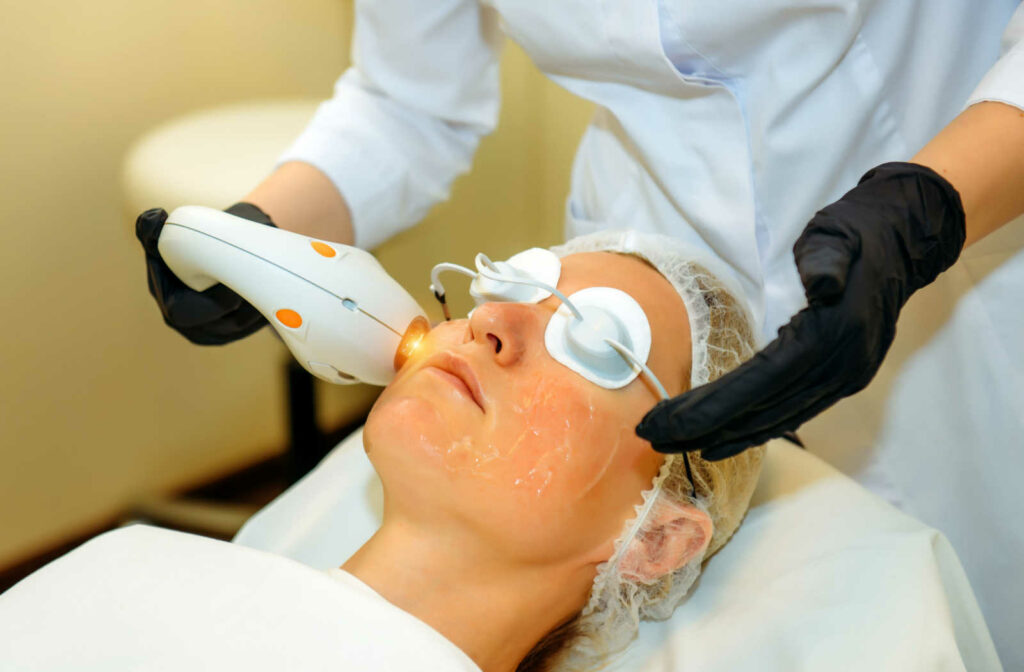 Does Laser Treatment Help With Rosacea? Calgary