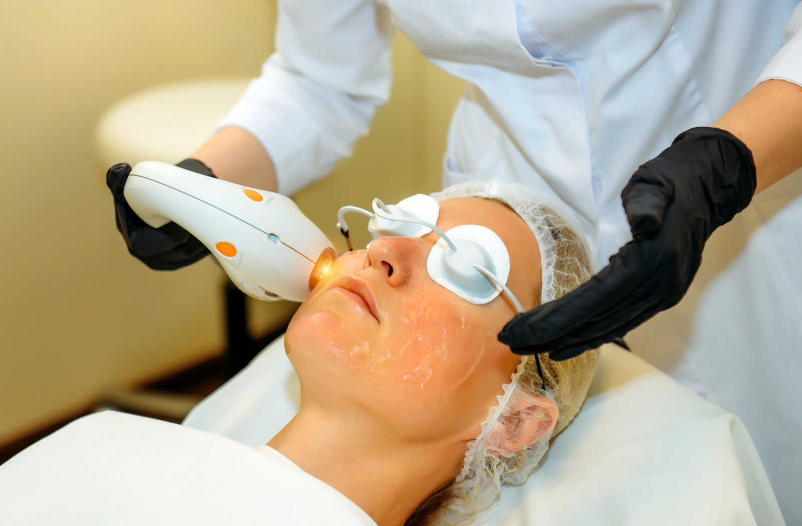 A woman receiving laser treatment for rosacea.