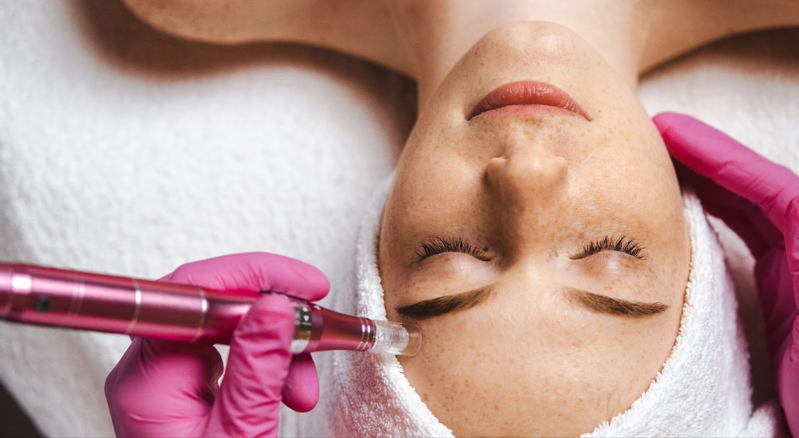 A close-up image of a woman with her eyes closed while a skincare professional performs microneedling.