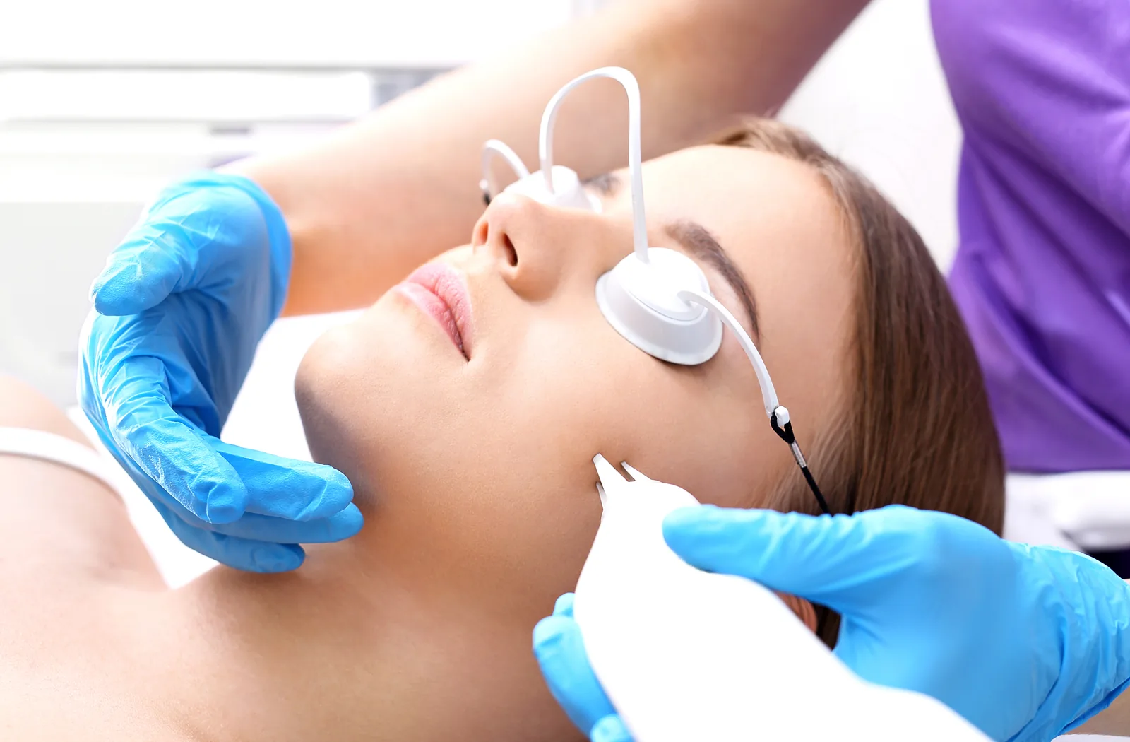 Laser scar removal process targeting acne scars for clear skin