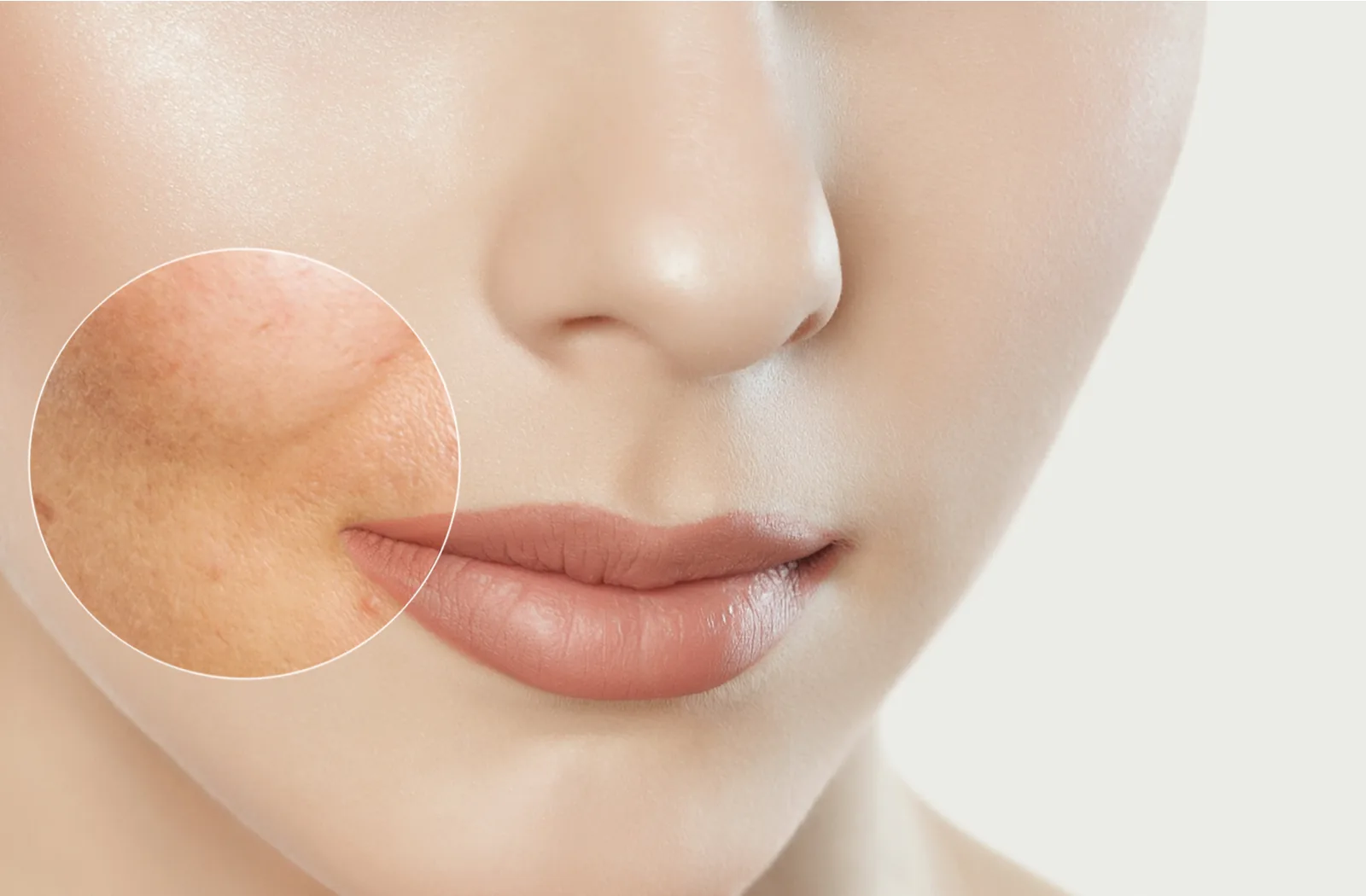 Transformative laser skin resurfacing treatment for smooth complexion.