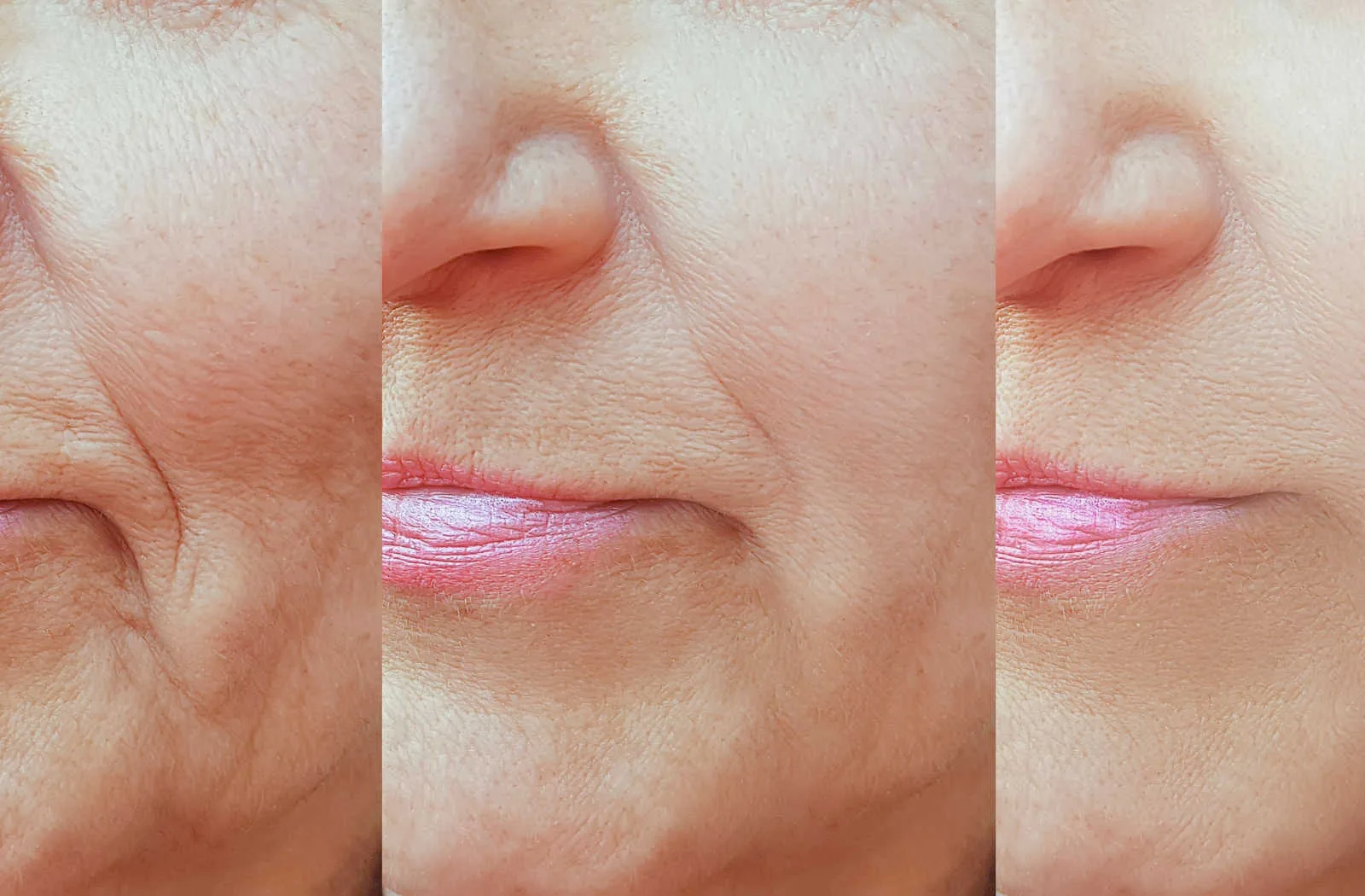 Comparison of an old woman's face with wrinkles before and after treatment.